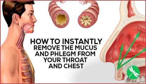 How do I get rid of thick mucus in my throat?