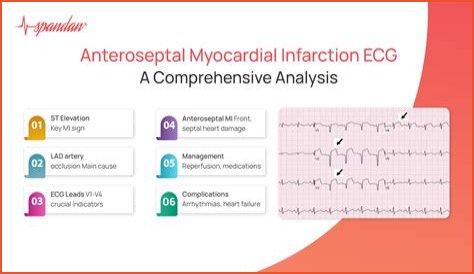 What does the medical term infarct mean?