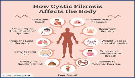 What is Fibrositis pain?